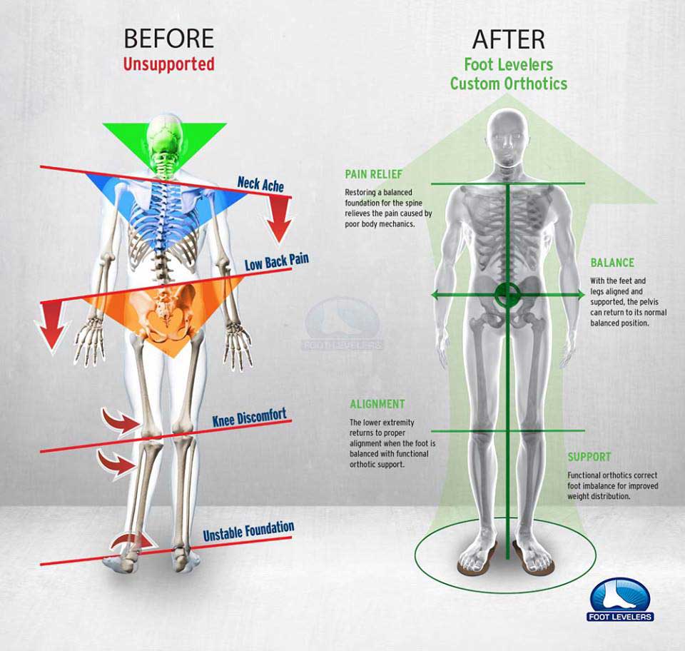 Chiropractic Watertown WI Foot Levelrs - Crooked Man vs Balanced Man